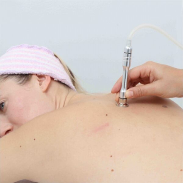 TS Back Microdermabrasion